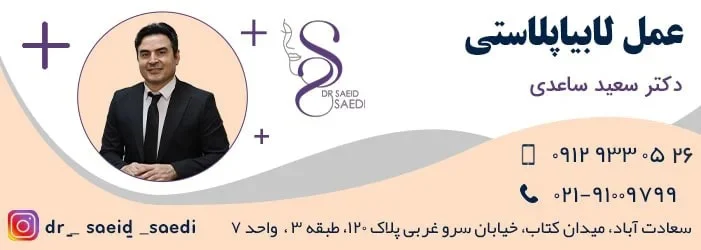اپل هزینه عمل لابیاپلاستی در سال ۱۴۰۳