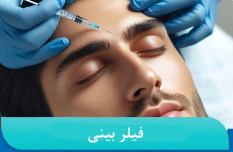 آیا فیلر بینی برای شما مناسب است؟ نکات مهم برای تصمیم گیری درست از زبان دکتر حمید رضا مفرد